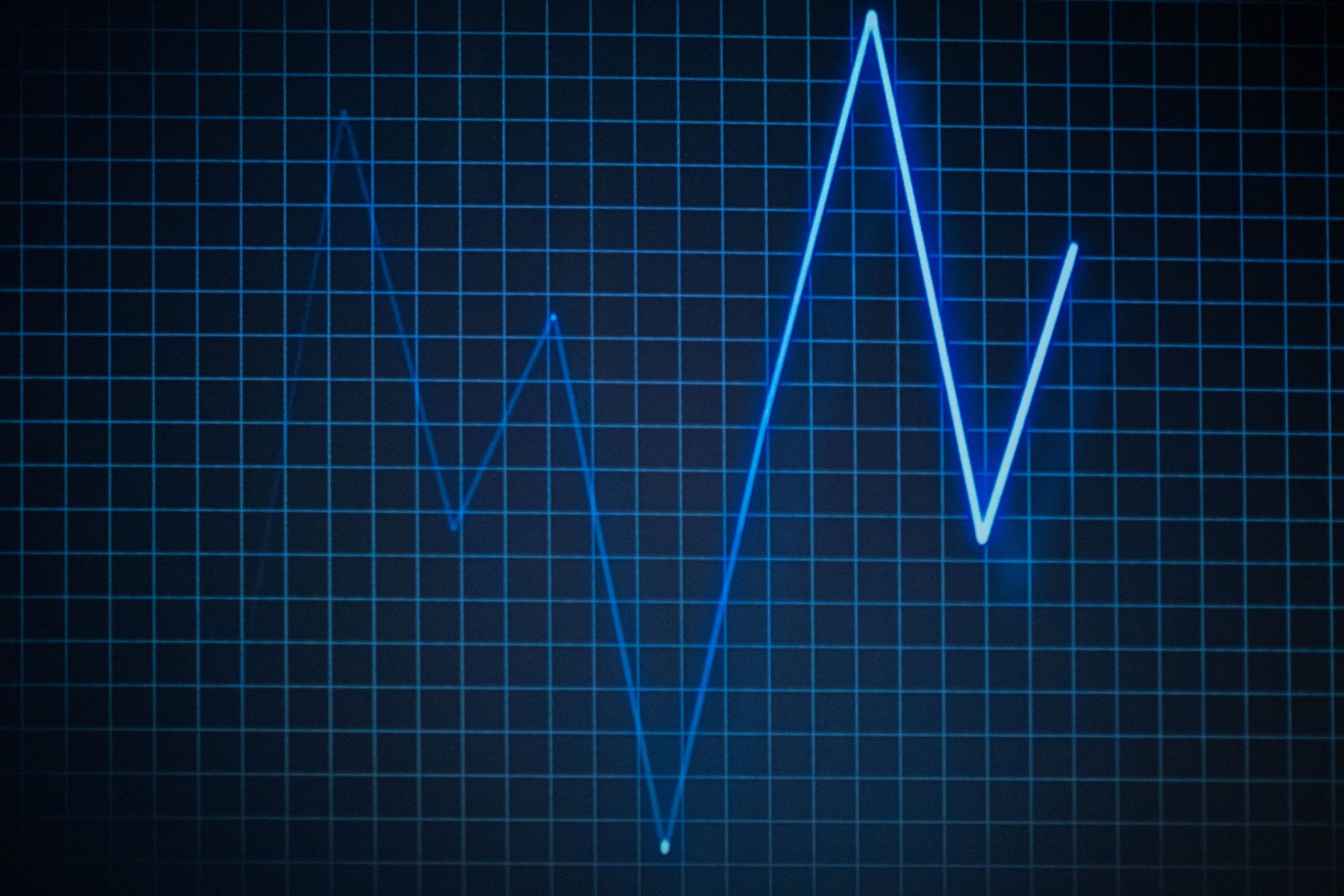 Signal Processing